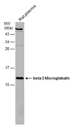 Anti-beta 2 Microglobulin antibody used in Western Blot (WB). GTX112815