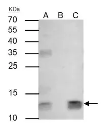 Anti-beta 2 Microglobulin antibody used in Immunoprecipitation (IP). GTX112815