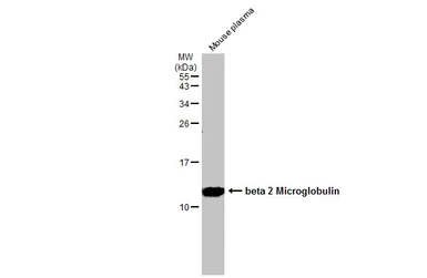 Anti-beta 2 Microglobulin antibody used in Western Blot (WB). GTX112815