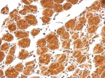 Anti-IL21 antibody used in IHC (Paraffin sections) (IHC-P). GTX112816