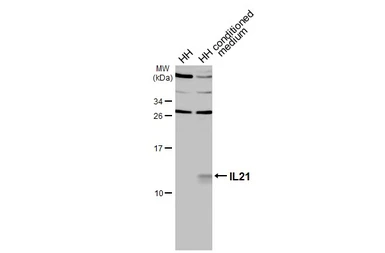Anti-IL21 antibody used in Western Blot (WB). GTX112816