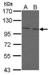 Anti-FcRH5 antibody [N2N3] used in Western Blot (WB). GTX112819