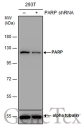 Anti-PARP antibody [N1N2], N-term used in Western Blot (WB). GTX112839