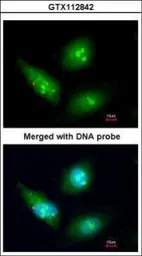 Anti-CDK4 antibody used in Immunocytochemistry/ Immunofluorescence (ICC/IF). GTX112842
