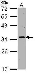 Anti-CDK4 antibody used in Western Blot (WB). GTX112842