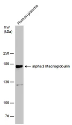 Anti-alpha 2 Macroglobulin antibody [N2N3] used in Western Blot (WB). GTX112856