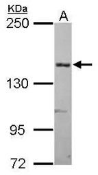 Anti-alpha 2 Macroglobulin antibody [N2N3] used in Western Blot (WB). GTX112856