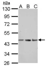 Anti-alpha Skeletal Muscle Actin antibody used in Western Blot (WB). GTX112860