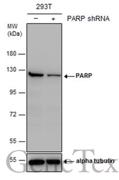 Anti-PARP antibody [N2C1], Internal used in Western Blot (WB). GTX112864