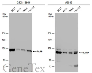 Anti-PARP antibody [N2C1], Internal used in Western Blot (WB). GTX112864