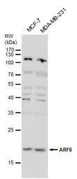 Anti-ARF6 antibody [N1C3] used in Western Blot (WB). GTX112872