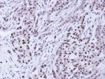 Anti-Bag1 antibody [N2C3] used in IHC (Paraffin sections) (IHC-P). GTX112873