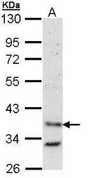Anti-Bag1 antibody [N2C3] used in Western Blot (WB). GTX112873