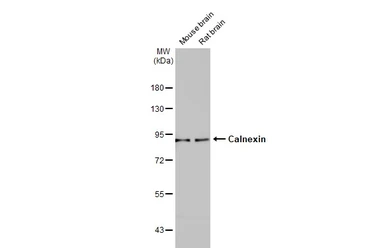 Anti-Calnexin antibody used in Western Blot (WB). GTX112886