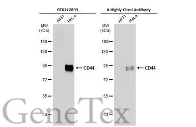 Anti-CD44 antibody [N1N2], N-term used in Western Blot (WB). GTX112893
