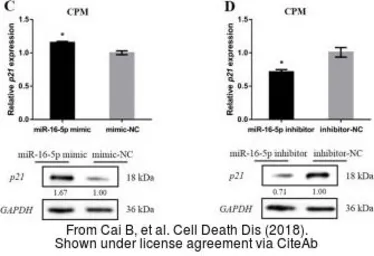 Anti-p21 Cip1 antibody used in Western Blot (WB). GTX112898