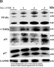 Anti-p21 Cip1 antibody used in Western Blot (WB). GTX112898