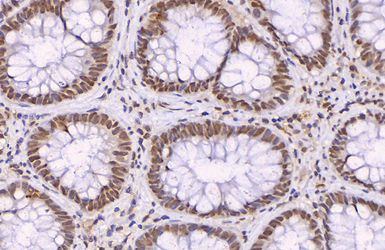 Anti-p21 Cip1 antibody used in IHC (Paraffin sections) (IHC-P). GTX112898