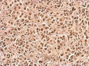 Anti-p21 Cip1 antibody used in IHC (Paraffin sections) (IHC-P). GTX112898