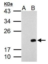 Anti-p21 Cip1 antibody used in Western Blot (WB). GTX112898