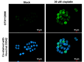 Anti-p21 Cip1 antibody used in Immunocytochemistry/ Immunofluorescence (ICC/IF). GTX112898