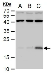 Anti-p21 Cip1 antibody used in Western Blot (WB). GTX112898