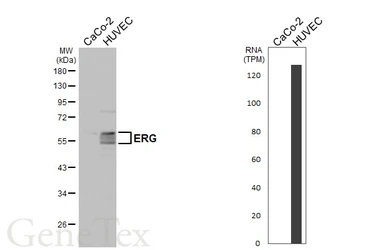 Anti-ERG antibody used in Western Blot (WB). GTX112925