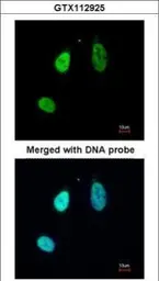 Anti-ERG antibody used in Immunocytochemistry/ Immunofluorescence (ICC/IF). GTX112925