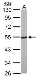 Anti-ERG antibody [N2C2], Internal used in Western Blot (WB). GTX112926