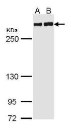 Anti-Filamin A antibody [C2], C-term used in Western Blot (WB). GTX112939