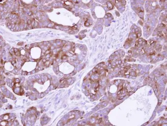 Anti-14-3-3 sigma antibody [N1C3-2] used in IHC (Paraffin sections) (IHC-P). GTX112949
