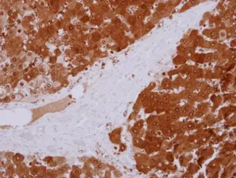Anti-GPT antibody [N2C2], Internal used in IHC (Paraffin sections) (IHC-P). GTX112952