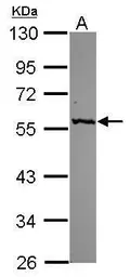Anti-GPT antibody [N2C2], Internal used in Western Blot (WB). GTX112952