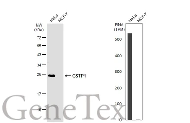 Anti-GSTP1 antibody used in Western Blot (WB). GTX112953