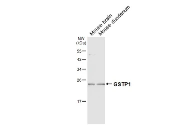 Anti-GSTP1 antibody used in Western Blot (WB). GTX112953