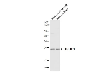 Anti-GSTP1 antibody used in Western Blot (WB). GTX112953