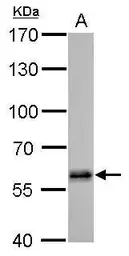 Anti-HDAC2 antibody used in Western Blot (WB). GTX112957