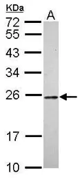Anti-HMGB1 antibody used in Western Blot (WB). GTX112959