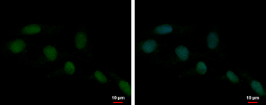 Anti-HMGB1 antibody used in Immunocytochemistry/ Immunofluorescence (ICC/IF). GTX112959