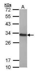 Anti-HMGB1 antibody used in Western Blot (WB). GTX112959