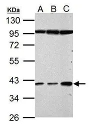 Anti-Haptoglobin antibody used in Western Blot (WB). GTX112962