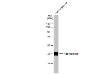 Anti-Haptoglobin antibody used in Western Blot (WB). GTX112962