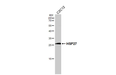 Anti-HSP27 antibody used in Western Blot (WB). GTX112964