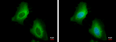 Anti-HSP27 antibody used in Immunocytochemistry/ Immunofluorescence (ICC/IF). GTX112964