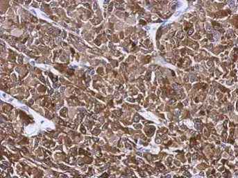 Anti-HSP27 antibody used in IHC (Paraffin sections) (IHC-P). GTX112964