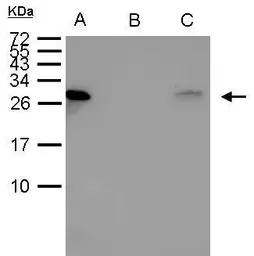 Anti-HSP27 antibody used in Immunoprecipitation (IP). GTX112964