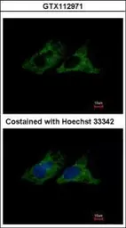 Anti-Integrin beta 1 / CD29 antibody used in Immunocytochemistry/ Immunofluorescence (ICC/IF). GTX112971