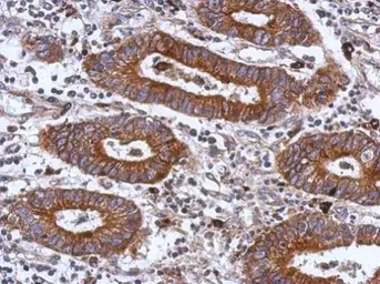Anti-Integrin beta 1 / CD29 antibody used in IHC (Paraffin sections) (IHC-P). GTX112971