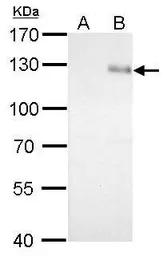 Anti-Integrin beta 1 / CD29 antibody used in Western Blot (WB). GTX112971