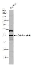 Anti-Cytokeratin 8 antibody [N1C1] used in Western Blot (WB). GTX112975